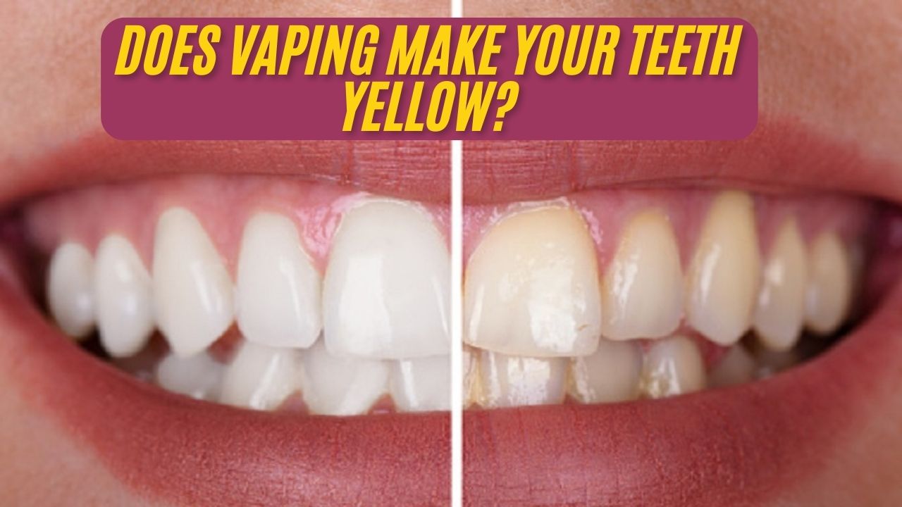 Does Vaping Make Your Teeth Yellow?