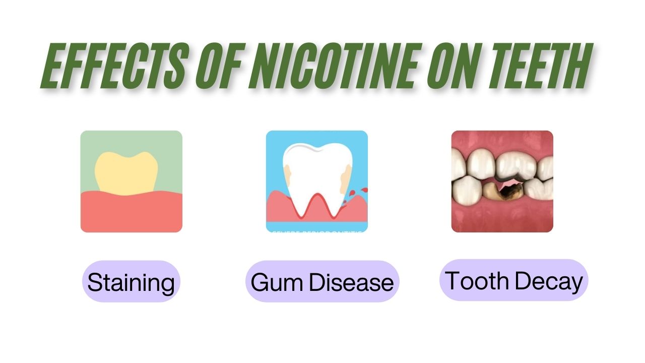 The Role of Nicotine in Tooth Discoloration