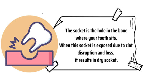 what is dry socket